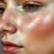 Nadmierny łojotok twarzy: przyczyny, objawy i skuteczne sposoby redukcji